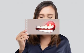 How Long Will It Take for You to Heal From Bleeding Gums?