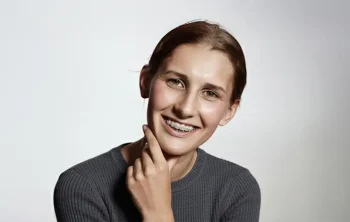 Why Are More Adults Getting Braces in Wenatchee, WA?